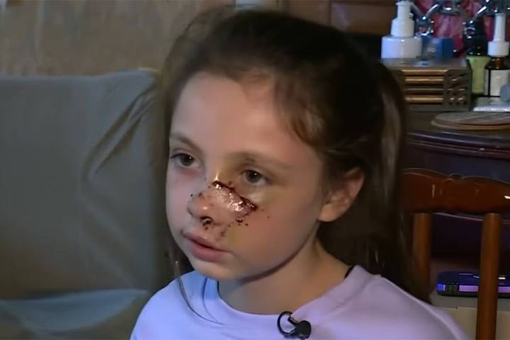 9-Year-Old Girl Mauled by Dog in Front of Her Shocked Sister
