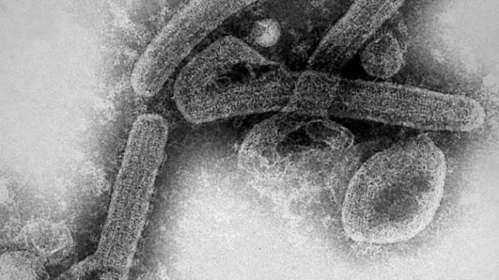 Confirman brote del virus de Marburgo en Etiopía