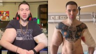 'Russian Popeye' At Risk of Double Arm Amputation After Severe Infection from Synthol Use