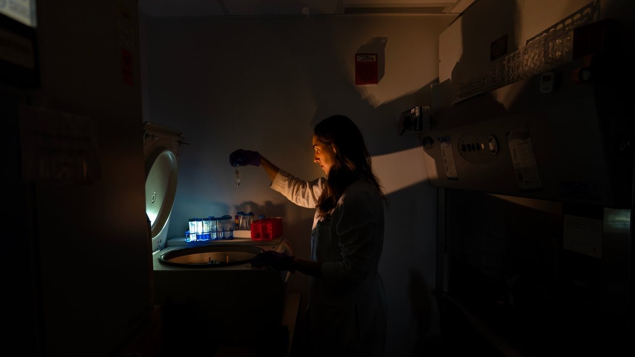 PHOTO ESSAY: Scientists trying to unravel one of the body's biggest mysteries