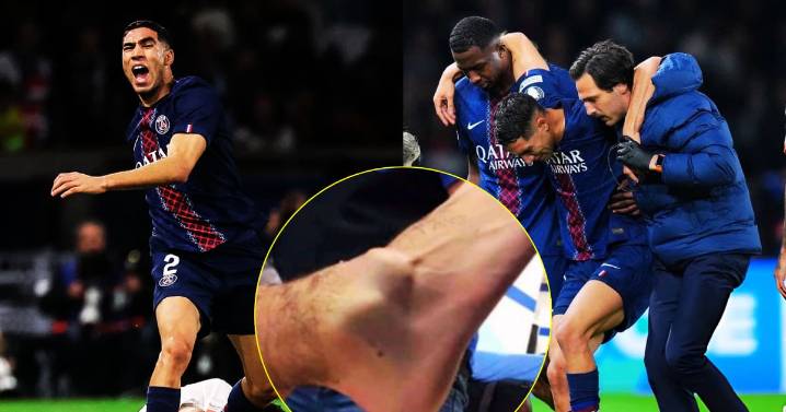 ¿Cuánto tiempo estará fuera Archraf Hakimi luego de la horrible lesión que sufrió en la Champions?