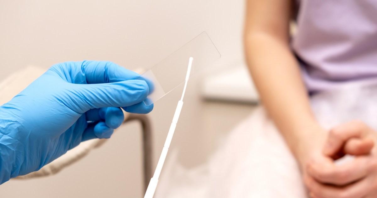 How long you should wait to test for each STI after unprotected sex