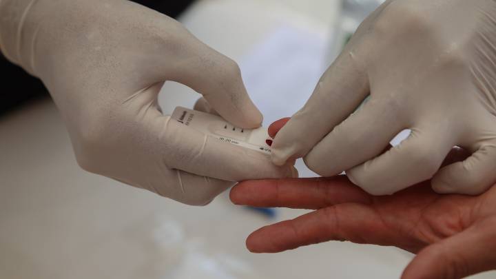 Los centros de prevención del SIDA notificaron 440 nuevos casos en la Comunitat en 2024