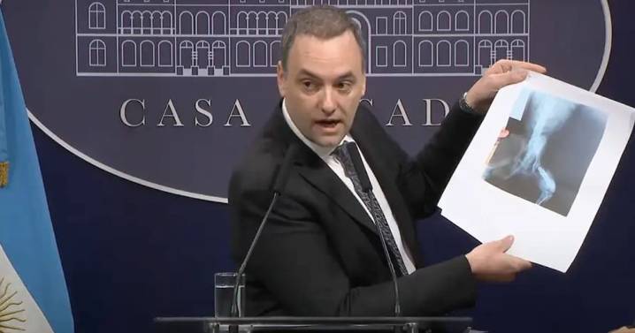 Cambia el Certificado Único de Discapacidad: cuándo se debe actualizarlo y qué condiciones hay que cumplir