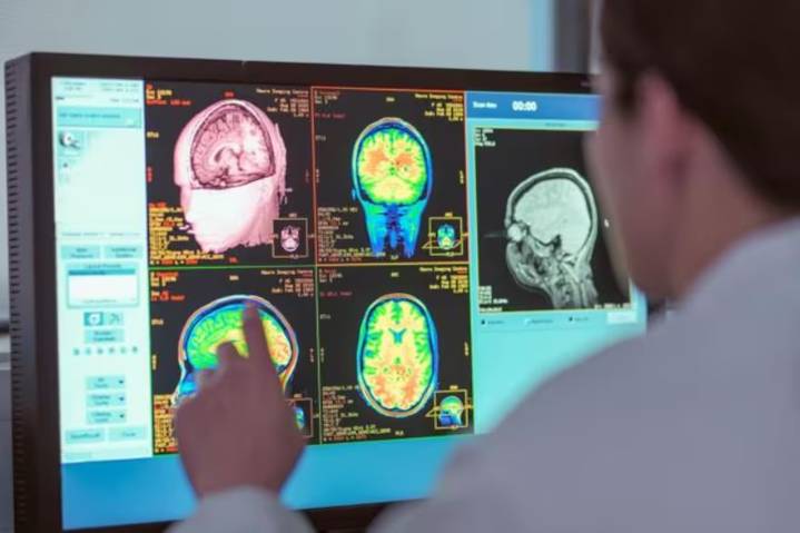 Un estudio asegura que la adolescencia dura hasta los 32 años