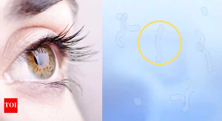 Eye Floaters: Seeing spots in your vision? Doctors reveal what’s happening inside your eyes