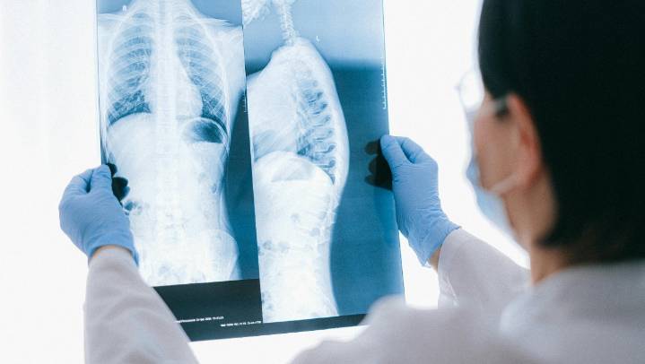 Nuevo León, tercer lugar en tumores malignos de tráquea, bronquios y pulmón a nivel nacional