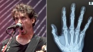 Gojira Frontman Joe Duplantier Undergoes Hand Surgery, Won't Play Guitar on Upcoming Tour