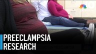 Doctors ramping up research on preeclampsia