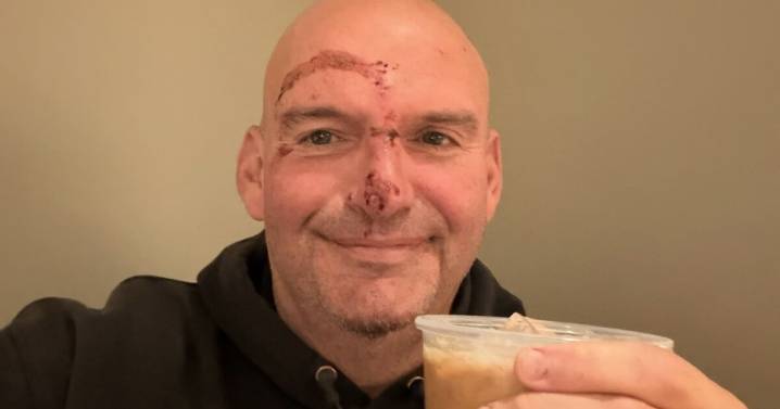 Fetterman shares photo of bloodied face after fall that sent him to hospital