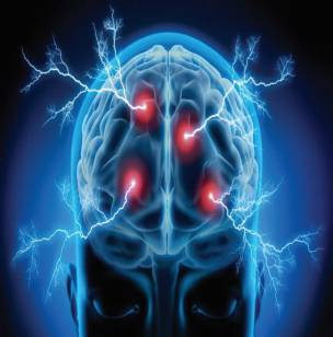 Epilepsy: Myths vs Reality