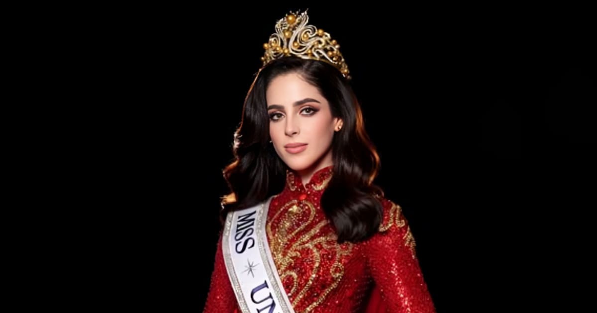 La enfermedad que padeció Fátima Bosch y que la llevó a sufrir bullying durante su infancia