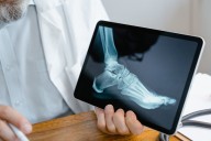 What Are the Benefits of Non-Surgical Orthopedic Care?