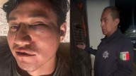 Policías de Ciudad Serdán irrumpen en una casa, golpean a joven y le fracturan las costillas; familia exige justicia