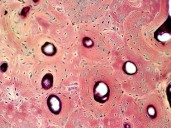 Científicos rusos crean aplicación para diagnóstico osteocondrosis