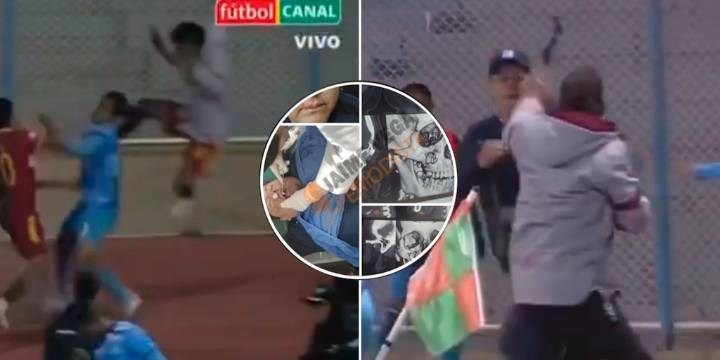 Un fracturado, gases, balas de goma y un DT argentino entre los 17 expulsados: el video de la batalla campal en Bolivia