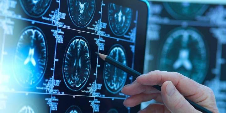 ¿Quieres un cerebro más joven? Mantén el músculo, pierde la grasa