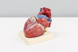 Study finds gout drug may reduce risk of heart attack and stroke