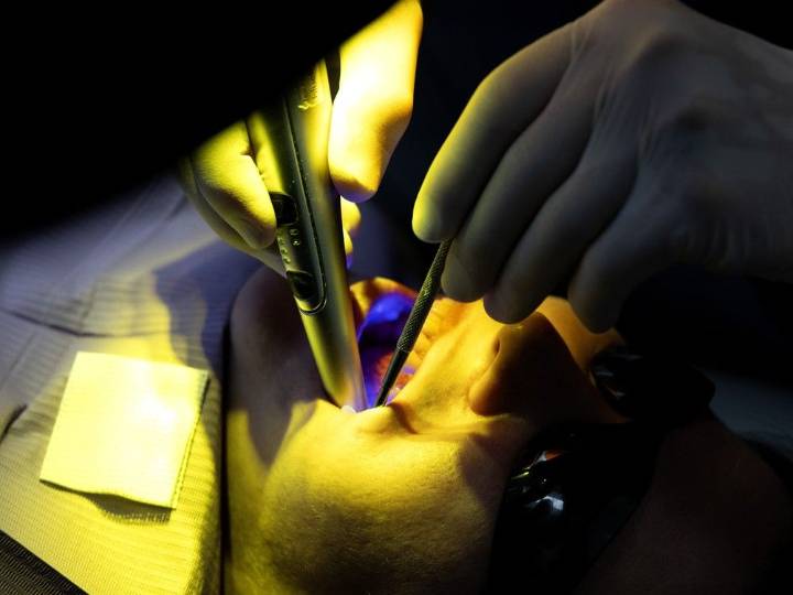 Labos: Should you worry about your mercury fillings?