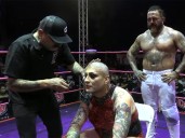 Mamba perdió la cabellera