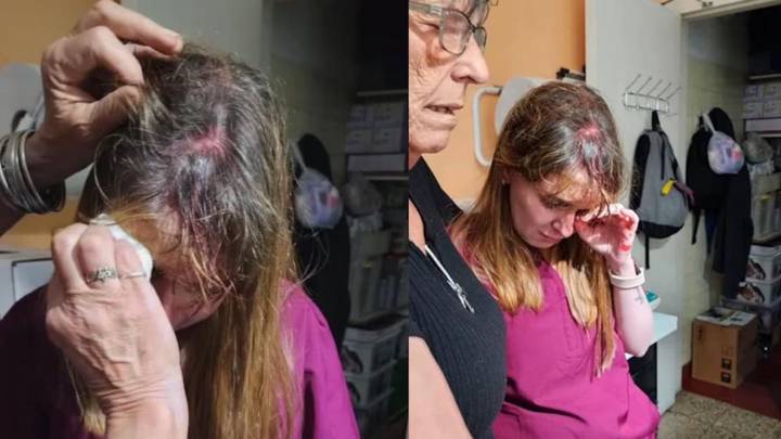 Córdoba capital: una veterinaria fue agredida con una tenaza en la cabeza por una clienta enojada