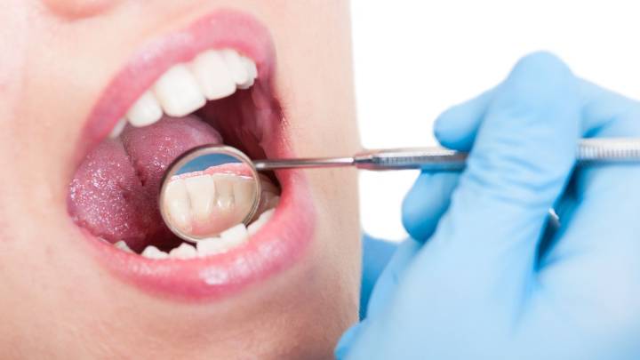 ¿Sensibilidad en los dientes? Puede ser abfracción dental