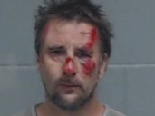 Bloody mugshot shows man after he jumped from moving car