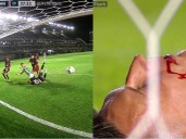 Video: el impactante corte en el rostro del arquero Losada en el gol de Banfield