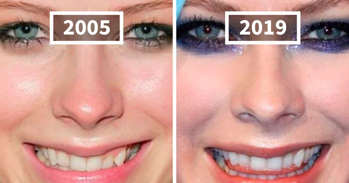 This Instagram Account Points Out How Much Celebrity Faces Have Changed Over The Years And Here Are 30 Of The Transformations