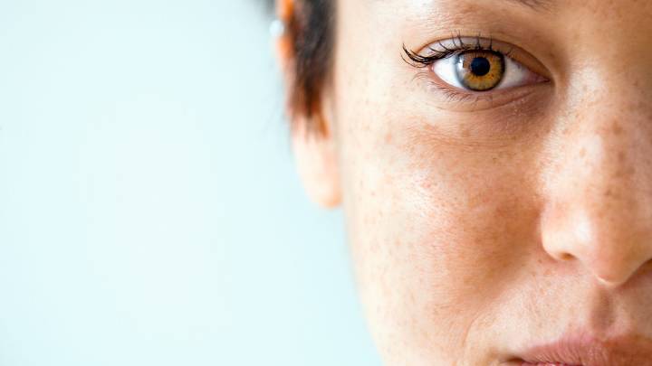 Paño de la cara: qué es y cómo quitarlo