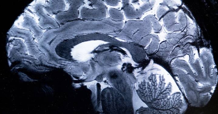 Brain Study Reveals Adolescence Lasts Until Shockingly Late in Life