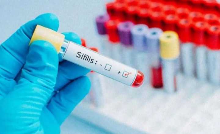 La Pampa: se redujeron casos de sífilis