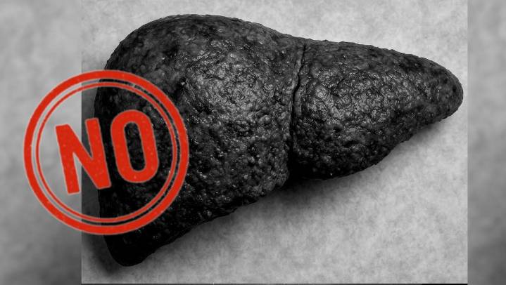 Atención. Esto debes comer para eliminar TODAS las toxinas y reducir la grasa del hígado de ma...