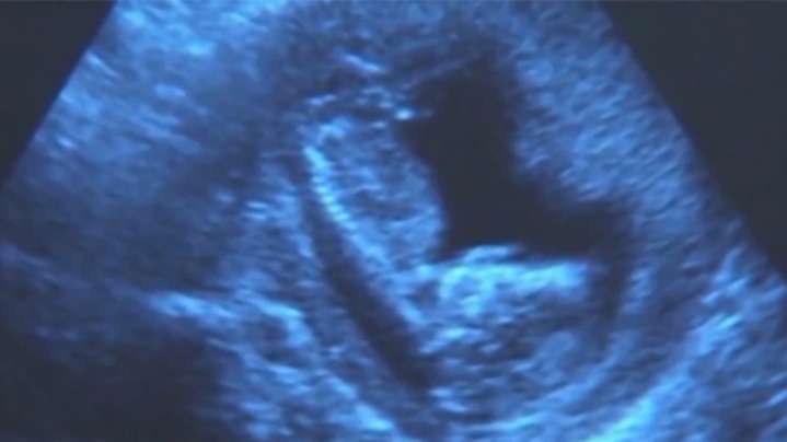 Measure to impose harsh abortion restrictions fails in SC Senate subcommittee