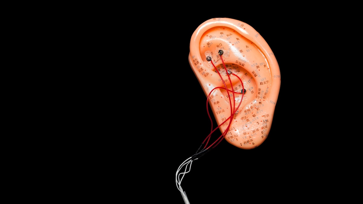 Can zapping your vagus nerve really ease anxiety?