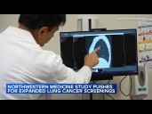 Northwestern Medicine study pushes for expanded lung cancer screenings