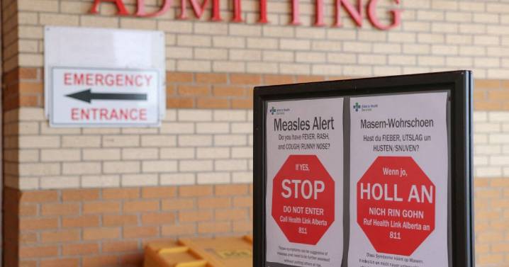 Canadá pierde su estatus como país libre de sarampión