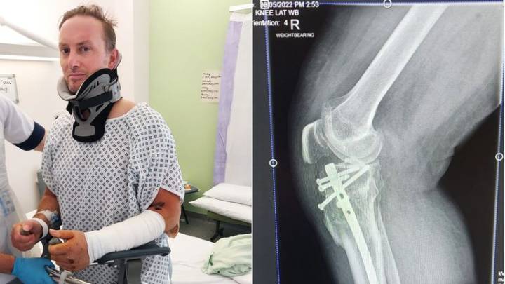 Worst areas for uninsured driving revealed - as hit-and-run victim says he was 'left for dead'