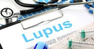 Un estudio de Stanford vincula el lupus a un virus común en casi toda la población