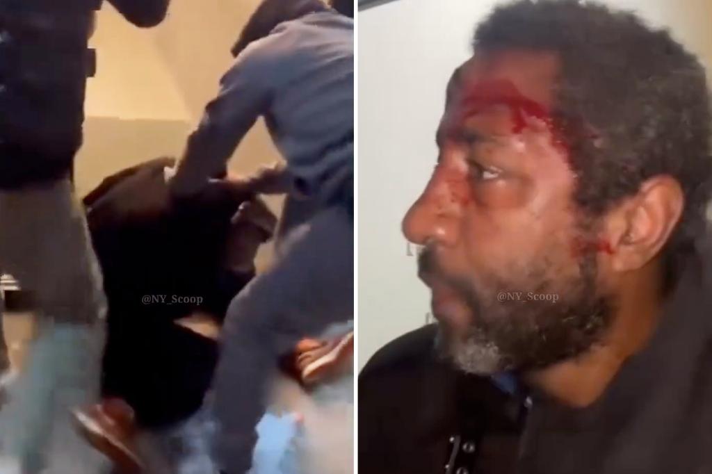 Brooklyn spitter left bloodied by two men 'tired' of his vile antics