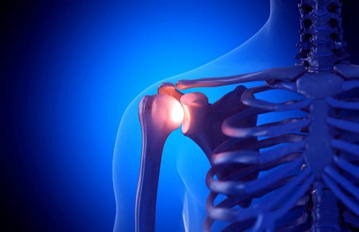 Patients With Underweight Have Poorer Outcomes After Shoulder Replacement