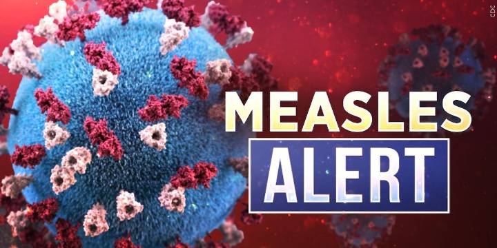 Nearly 20 people in quarantine as another measles case reported in Upstate outbreak