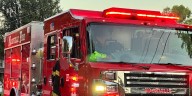 Nashville house fire leaves resident with burns to face, body