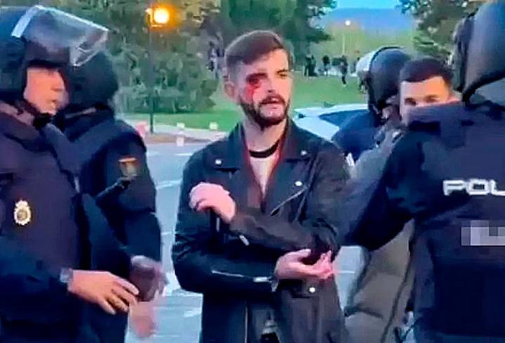 El Consejo de Europa exige al Gobierno que condene "el ataque" de los abertzales a un periodista en Pamplona y pide una "investigación exhaustiva"