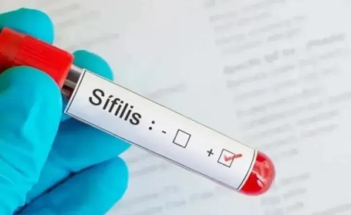 Los casos de sífilis aumentaron casi un 70% en cinco años: alerta de los expertos por el avance de la infección
