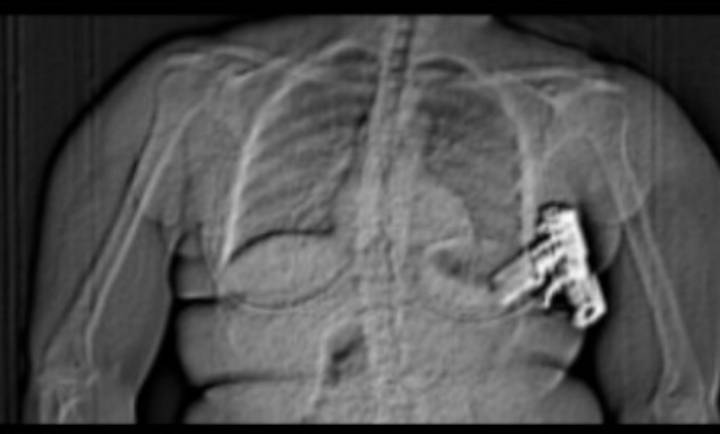 Georgia woman gets time behind bars for smuggling gun into Michigan jail via bra