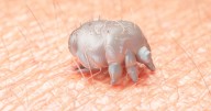 Scabies surges in UK as cases of parasitic medieval skin disease double