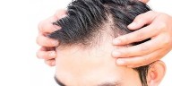 4 razones para realizar un injerto capilar en Madrid