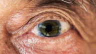 First-of-Its-Kind Treatment Boosts Vision in Human Trial, Scientists Report