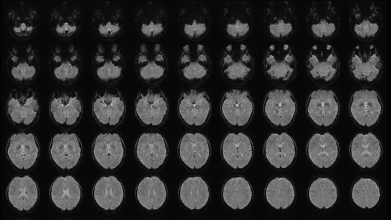 Scientist turns people’s mental images into text using ‘mind